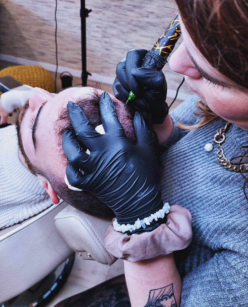 Exemple de micropigmentation barbe, technique effet densité
